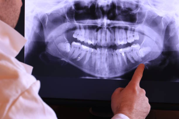 Best Knocked-Out Tooth Emergency  in Mountain City, GA